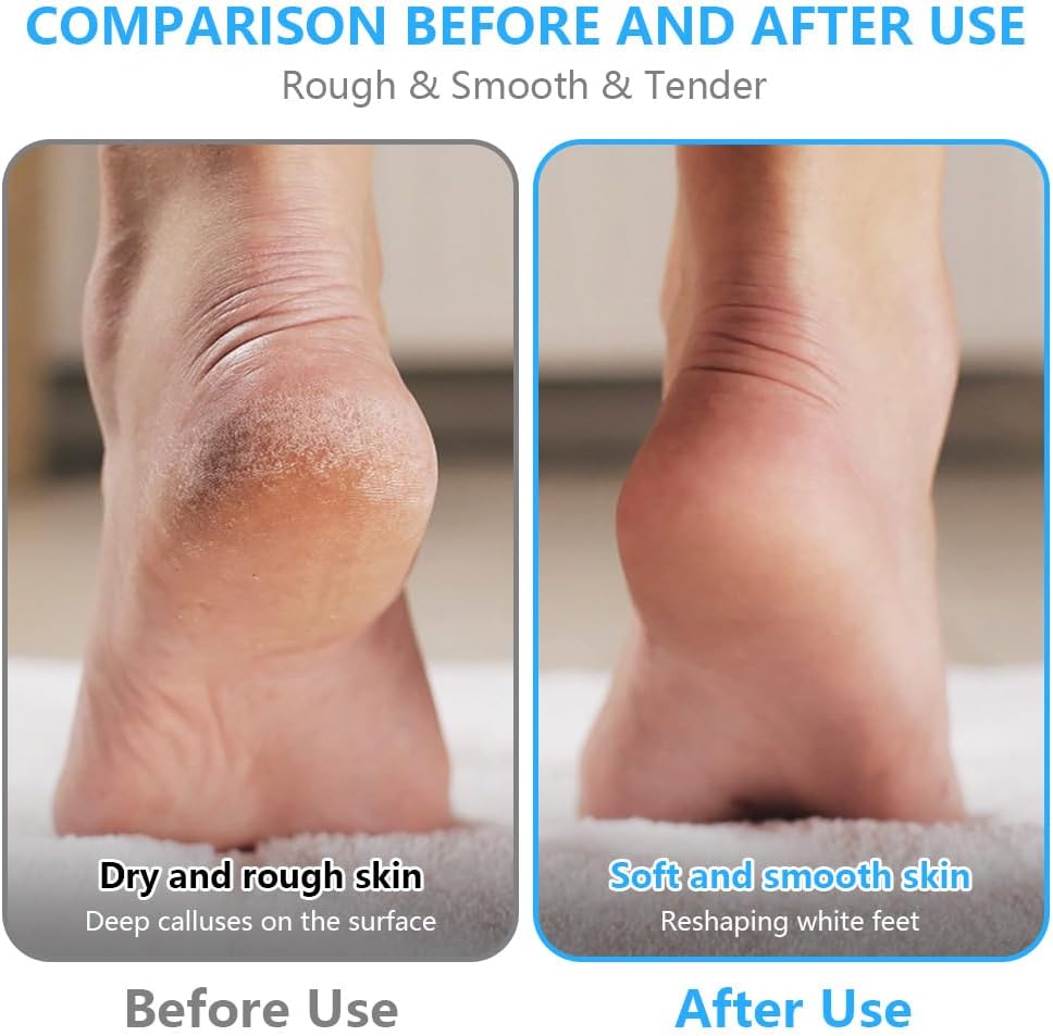 Ponceuse de pied électrique, pédicure, deux vitesses et deux têtes, dur ou doux, rechargeable usb/soyez sublime – Image 6