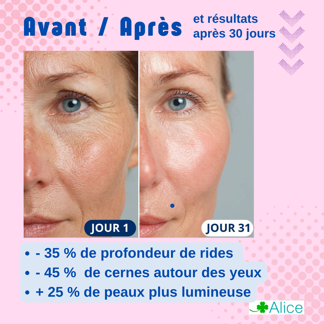 Masque LED Visage et Cou, Anti-Âge Anti-Rides, 4 Couleurs, 300 LED avec Infrarouge, Silicone Médical, pour Peaux a imperfection ou bien anti-age. Cure de 30 jours, repulpe, luminothérapie, – Image 7